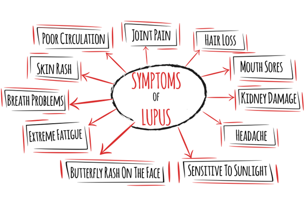 Managinglupus-(1).png